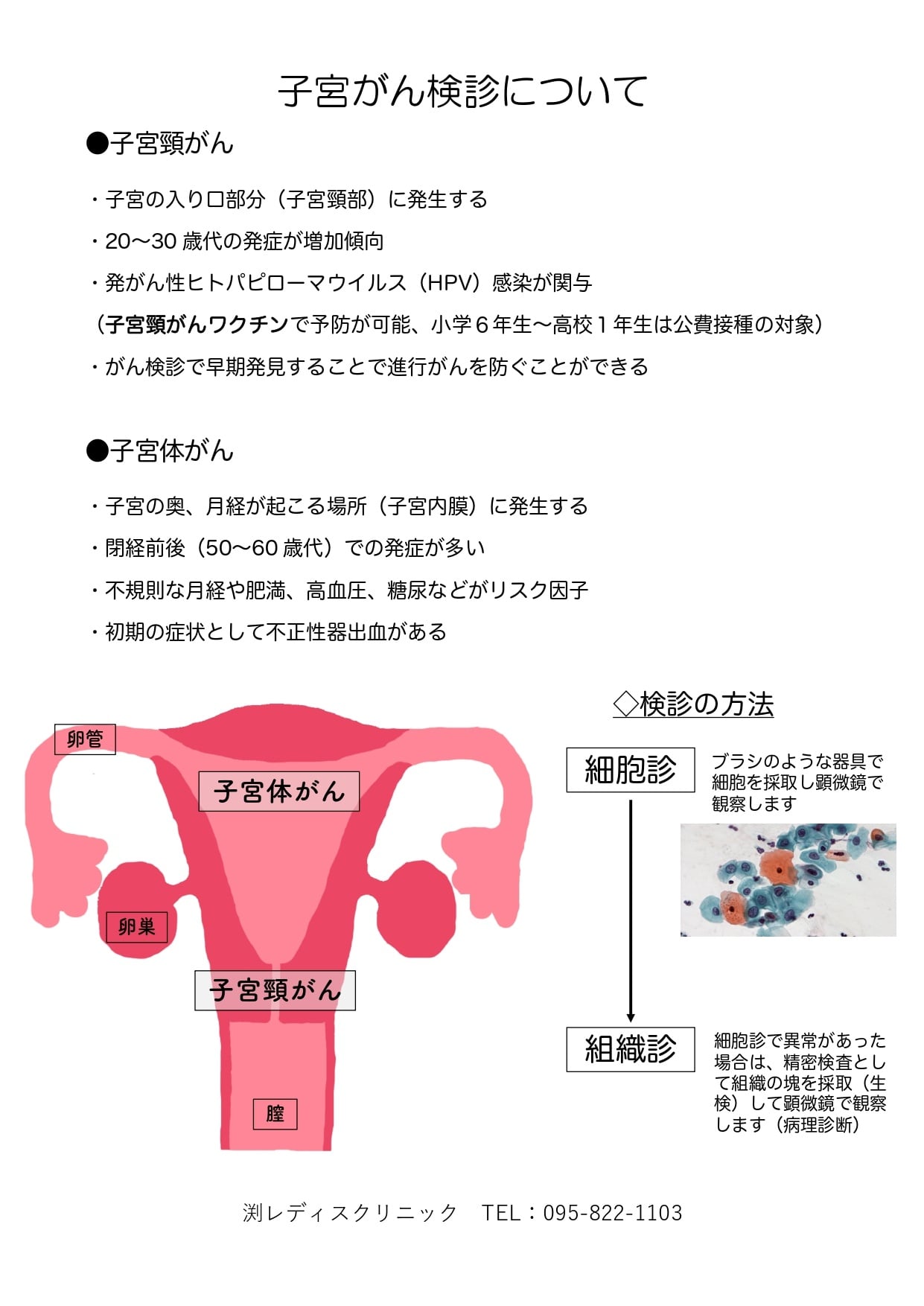 子宮頸がん 3b